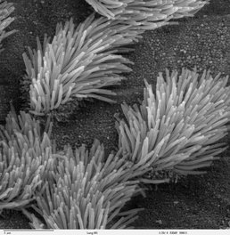 Lung trachea epithelium Lung trachea epithelium